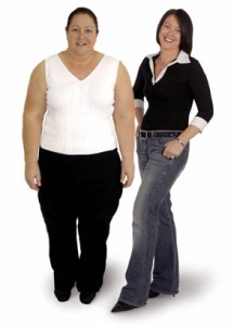 Before and After with Roca Labs Gastric Bypass